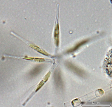 Рис. 7. Диатомея Asterionellopsis karianus, фрагмент колонии	