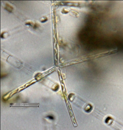 Рис. 9 Диатомея Thalassionema nitzschioides, колония из 4-х клеток
